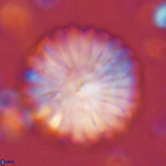 Discoaster multiradiatus 43716