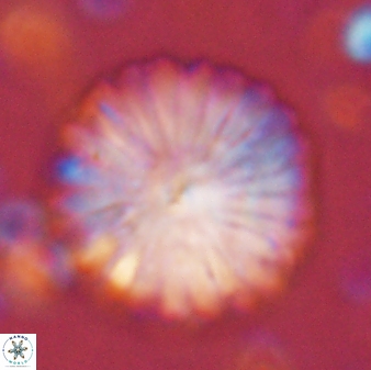 Discoaster multiradiatus 43716