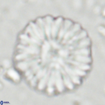 Discoaster multiradiatus 43718