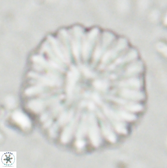 Discoaster multiradiatus 43718