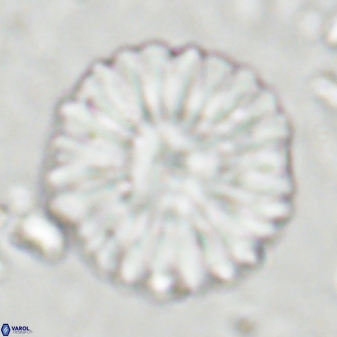 Discoaster multiradiatus 43720
