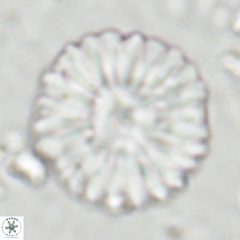 Discoaster multiradiatus 43720