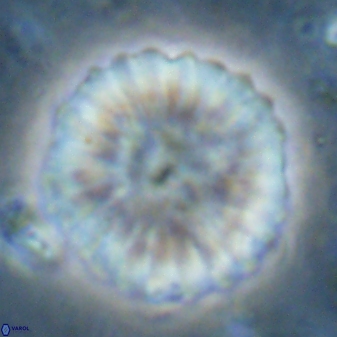 Discoaster multiradiatus 43721