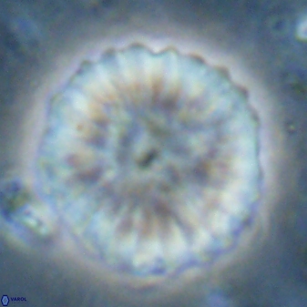 Discoaster multiradiatus 43722