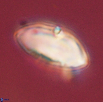 Discoaster multiradiatus 43913