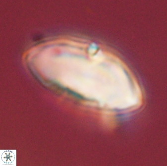 Discoaster multiradiatus 43913