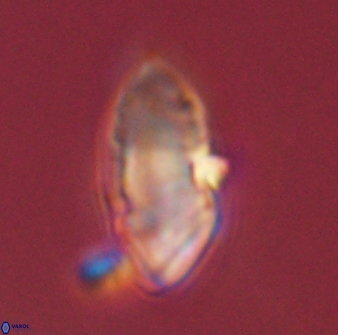 Discoaster multiradiatus 43914