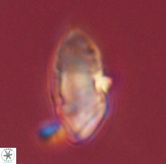 Discoaster multiradiatus 43914