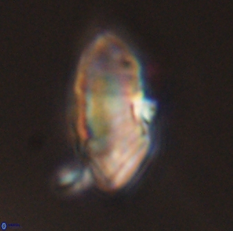 Discoaster multiradiatus 43915