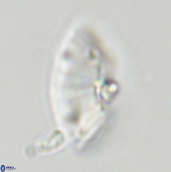Discoaster multiradiatus 43916
