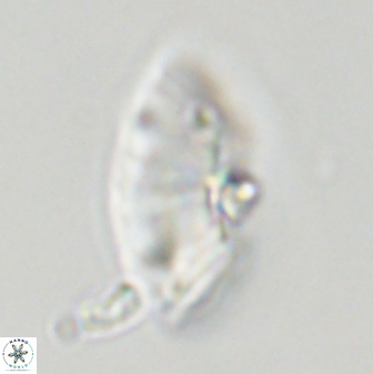 Discoaster multiradiatus 43916