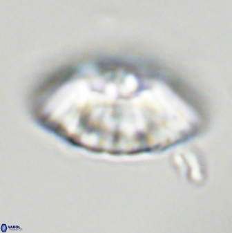 Discoaster multiradiatus 43917