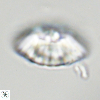 Discoaster multiradiatus 43917