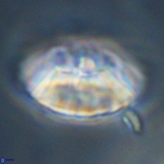 Discoaster multiradiatus 43918