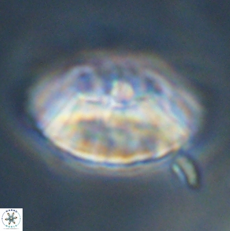 Discoaster multiradiatus 43918