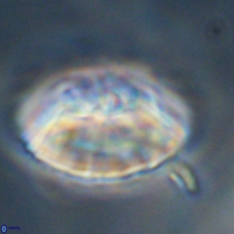 Discoaster multiradiatus 43919