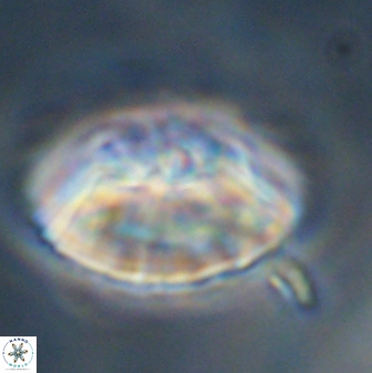 Discoaster multiradiatus 43919