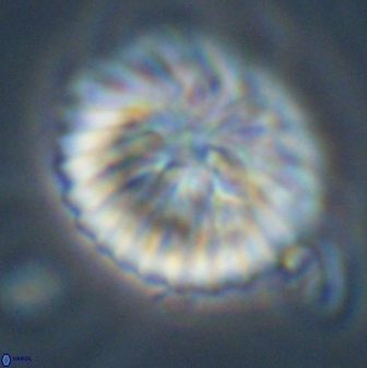 Discoaster multiradiatus 43920