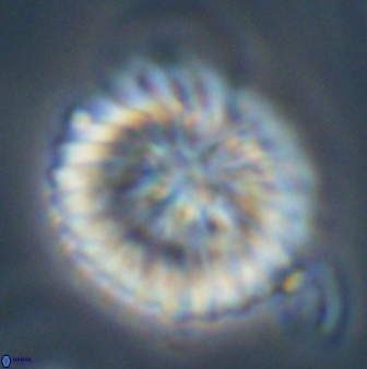 Discoaster multiradiatus 43921