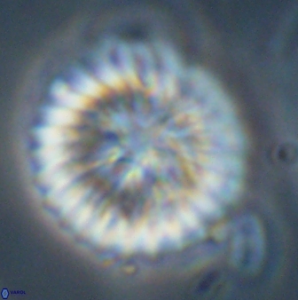Discoaster multiradiatus 43922