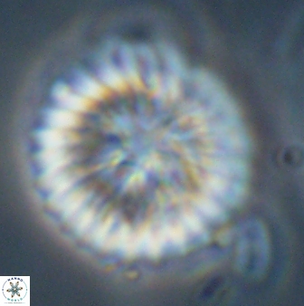 Discoaster multiradiatus 43922