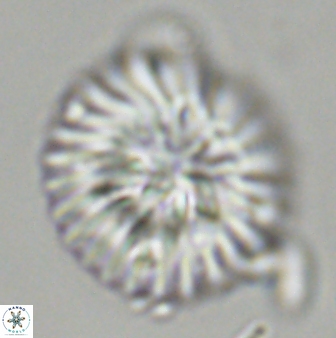 Discoaster multiradiatus 43923