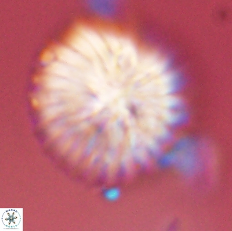 Discoaster multiradiatus 43926