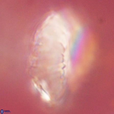 Discoaster multiradiatus 43932