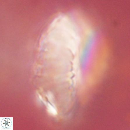Discoaster multiradiatus 43932