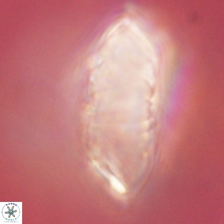 Discoaster multiradiatus 43933
