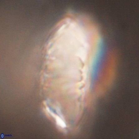 Discoaster multiradiatus 43934