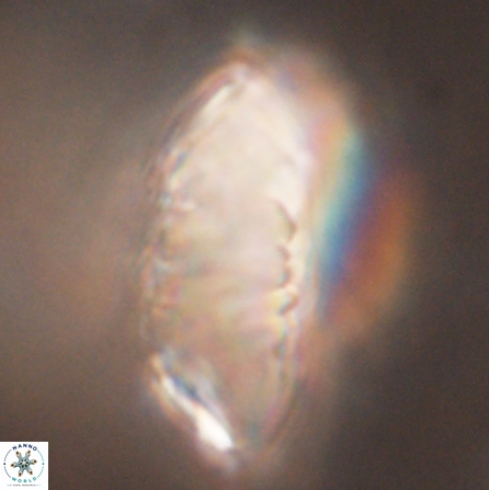 Discoaster multiradiatus 43934