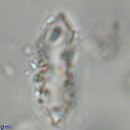 Discoaster multiradiatus 43935