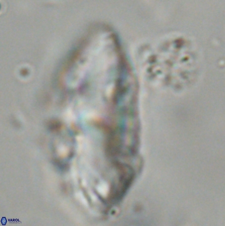 Discoaster multiradiatus 43936