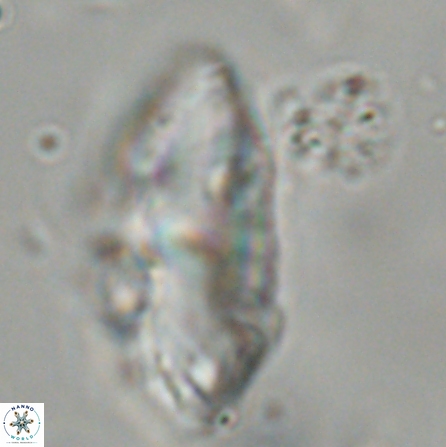 Discoaster multiradiatus 43936