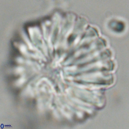 Discoaster multiradiatus 43939