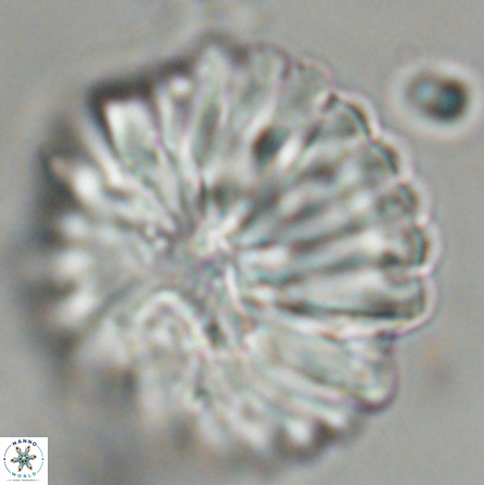 Discoaster multiradiatus 43939