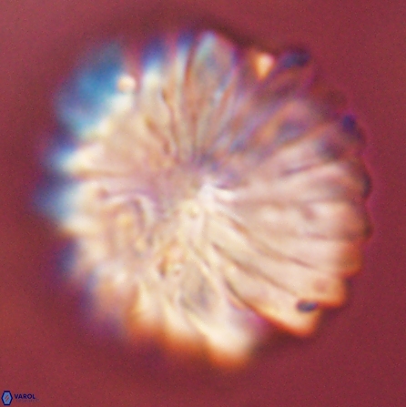 Discoaster multiradiatus 43945