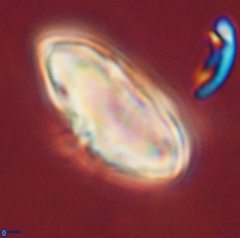 Discoaster multiradiatus 44046