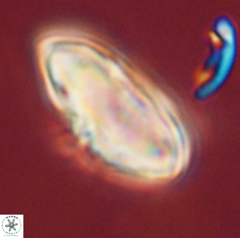 Discoaster multiradiatus 44046