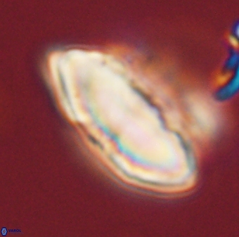 Discoaster multiradiatus 44047