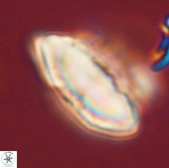 Discoaster multiradiatus 44047