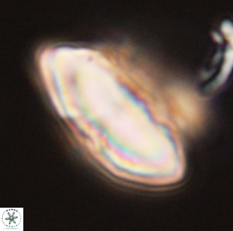 Discoaster multiradiatus 44048