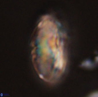 Discoaster multiradiatus 44049