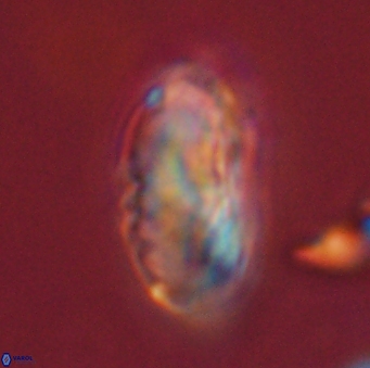 Discoaster multiradiatus 44050