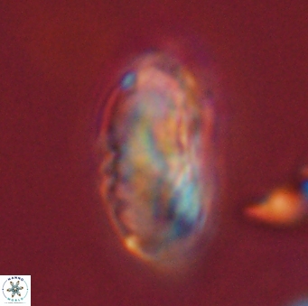 Discoaster multiradiatus 44050