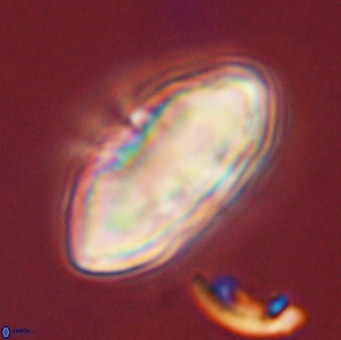 Discoaster multiradiatus 44051
