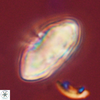 Discoaster multiradiatus 44051
