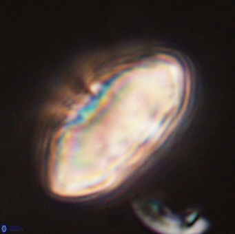 Discoaster multiradiatus 44052