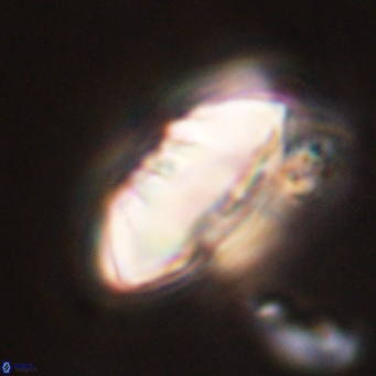 Discoaster multiradiatus 44053